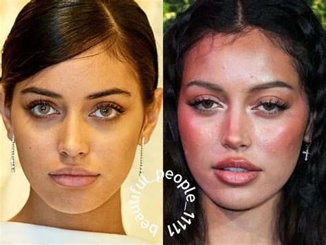 Cindy Kimberly Before and After Plastic Surgery: Lips, Nose, Face